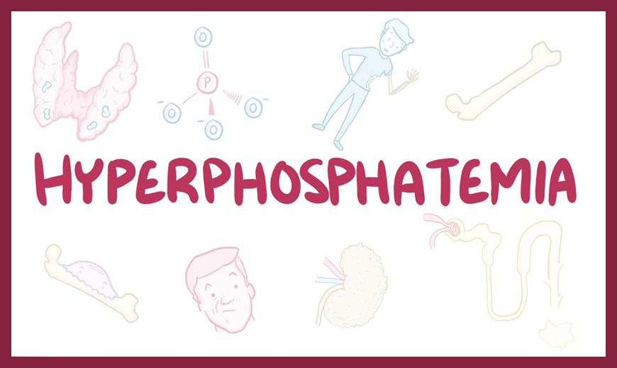 Hyperphosphatemia and Phosphate Binding Agents